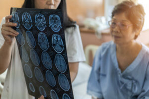 Brain MRI presented to concerned older woman
